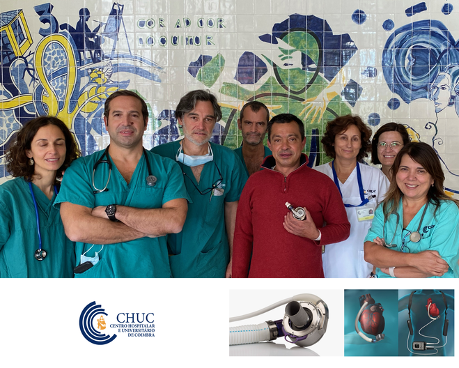 Assistência ventricular como ponte para candidatura