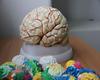cerebro
