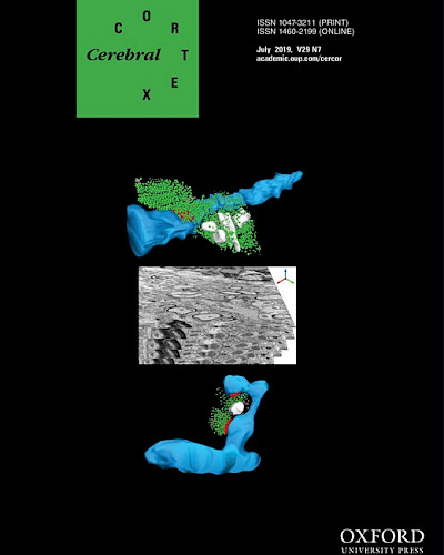 Domain-Specific Diaschisis: Lesions to Parietal Action Areas Modulate Neural Responses to Tools in the Ventral Stream.